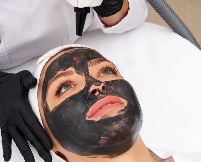 Carbon Hollywood Peeling - Kosmetikstudio in Mannheim - Kosmetiklounge