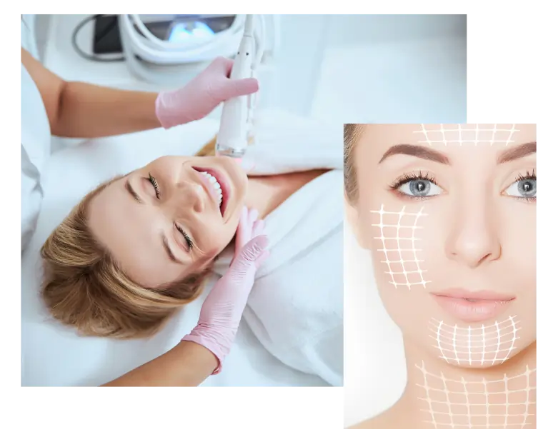 Kosmetiklounge Mannheim - Kosmetikstudio - Radiofrequenz Microneedling