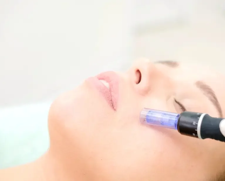 Microneedling Behandlung in Kosmetikstudio in Mannheim Innenstadt - Gtastyy